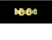 Cod.E6 f Upper Anterior: 10x  hollow pontics blocks-frames, (12-22), carved to fit into wax veneers Cod.E6Upper Anterior, MEDIUM, (13-23), for porcelain pressed to metal bridgework
